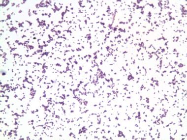 Gram Stain: Reference Range, Interpretation, Collection .